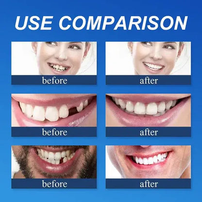 🌎Ends Today: 80% OFF!⏰FRASIRA™ Custom-Fit Smile Support Kit — Strong Suction Feel & Natural-Looking Fit