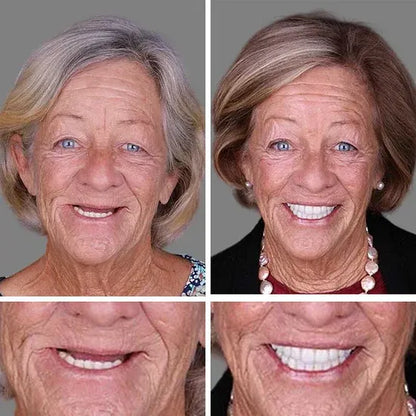 🌎Ends Today: 80% OFF!⏰FRASIRA™ Custom-Fit Smile Support Kit — Strong Suction Feel & Natural-Looking Fit